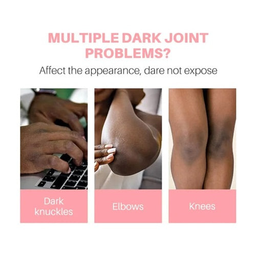 Fade Away Dark Knuckles, Knees and Elbows Cream