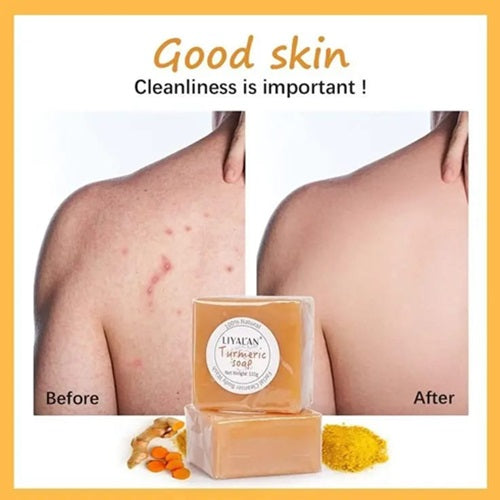 Turmeric Brightening Soap – 2 Pack