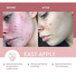 Pink Rose Clay Mask (Black Head Remover and Shrinks Pores)