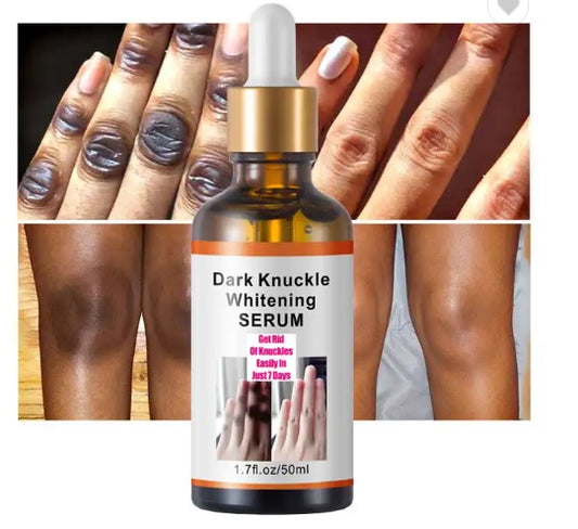 Dark Knuckle Whitening Serum