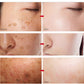 Dark Spot Corrector Cream