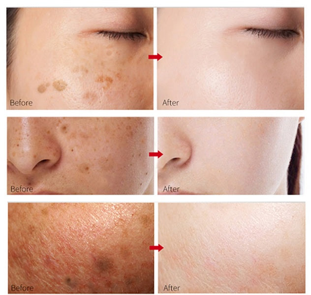 Dark Spot Corrector Cream