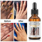 Dark Knuckle Whitening Serum