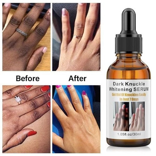 Dark Knuckle Whitening Serum