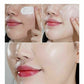 Whitening Sunscreen with Kojic Acid