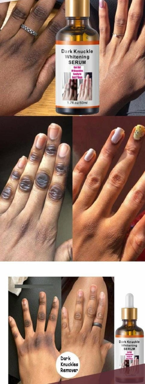 Dark Knuckle Whitening Serum
