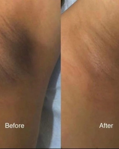Intense Whitening Scrub