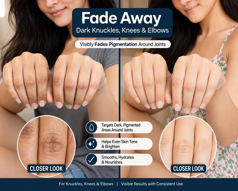 Fade Away Dark Knuckles, Knees and Elbows Cream
