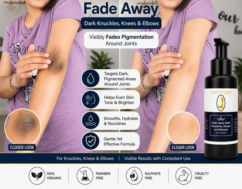 Fade Away Dark Knuckles, Knees and Elbows Cream