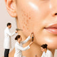 Acne & Spot Treat