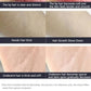 Ice Cooling IPL Hair Removal Device