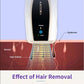 Ice Cooling IPL Hair Removal Device