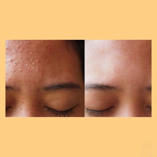 Kojic Acid Brightening Serum